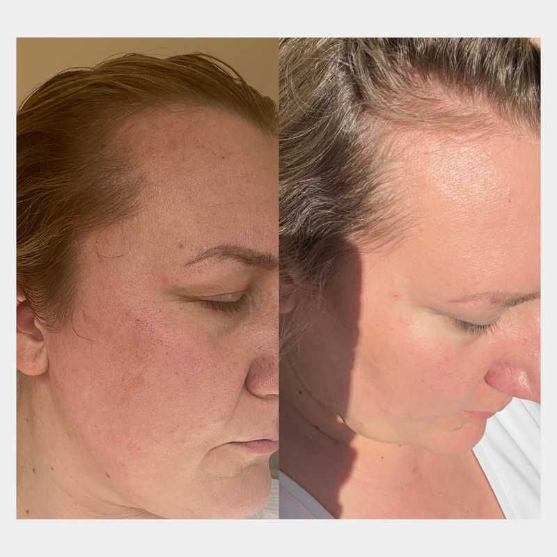 Mehr Glow. Weniger Falten. Sichtbar straffere Haut in 30 Tagen. ✨
